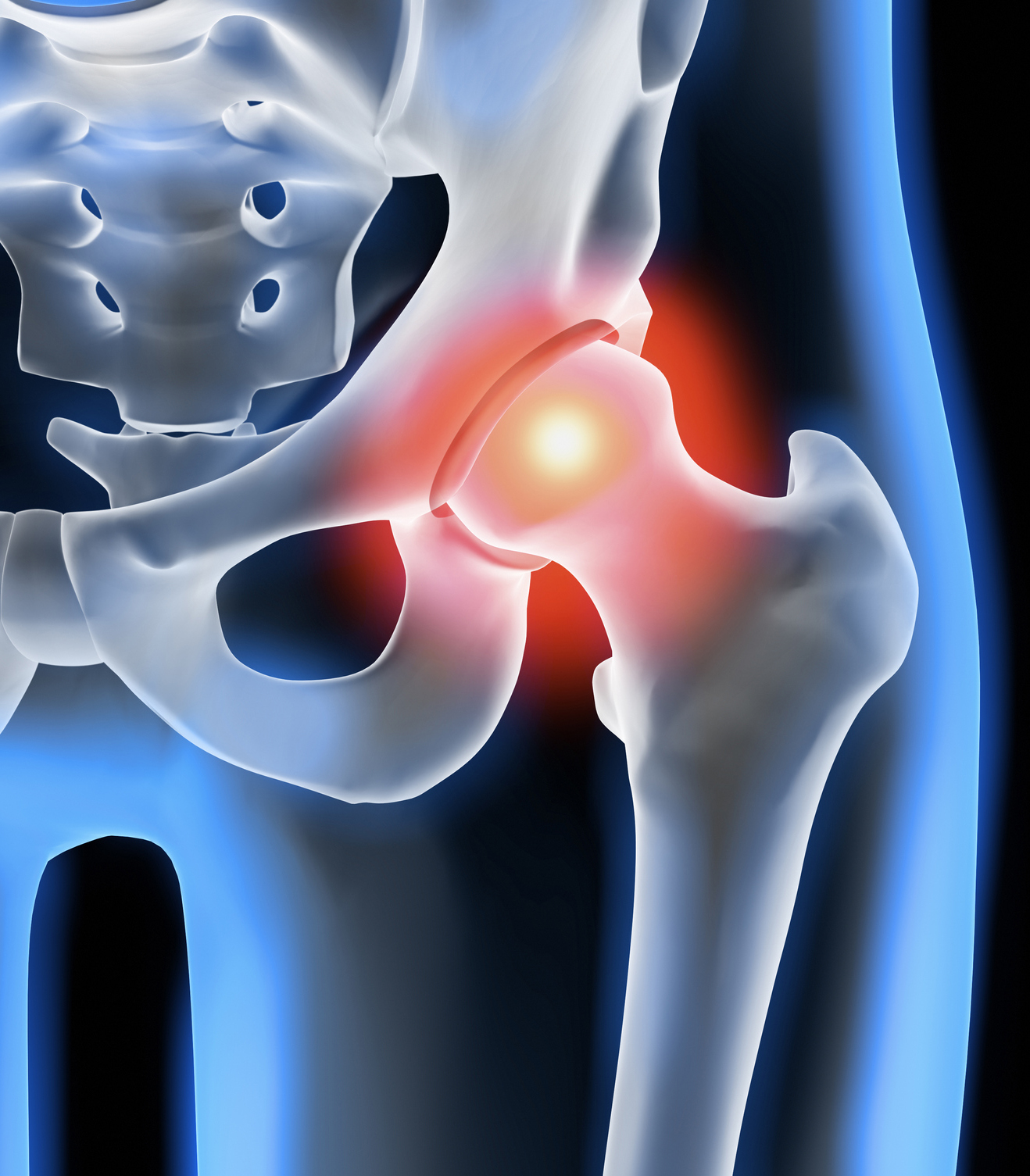 Hip/Joint Pain in Hollywood & Miami FL